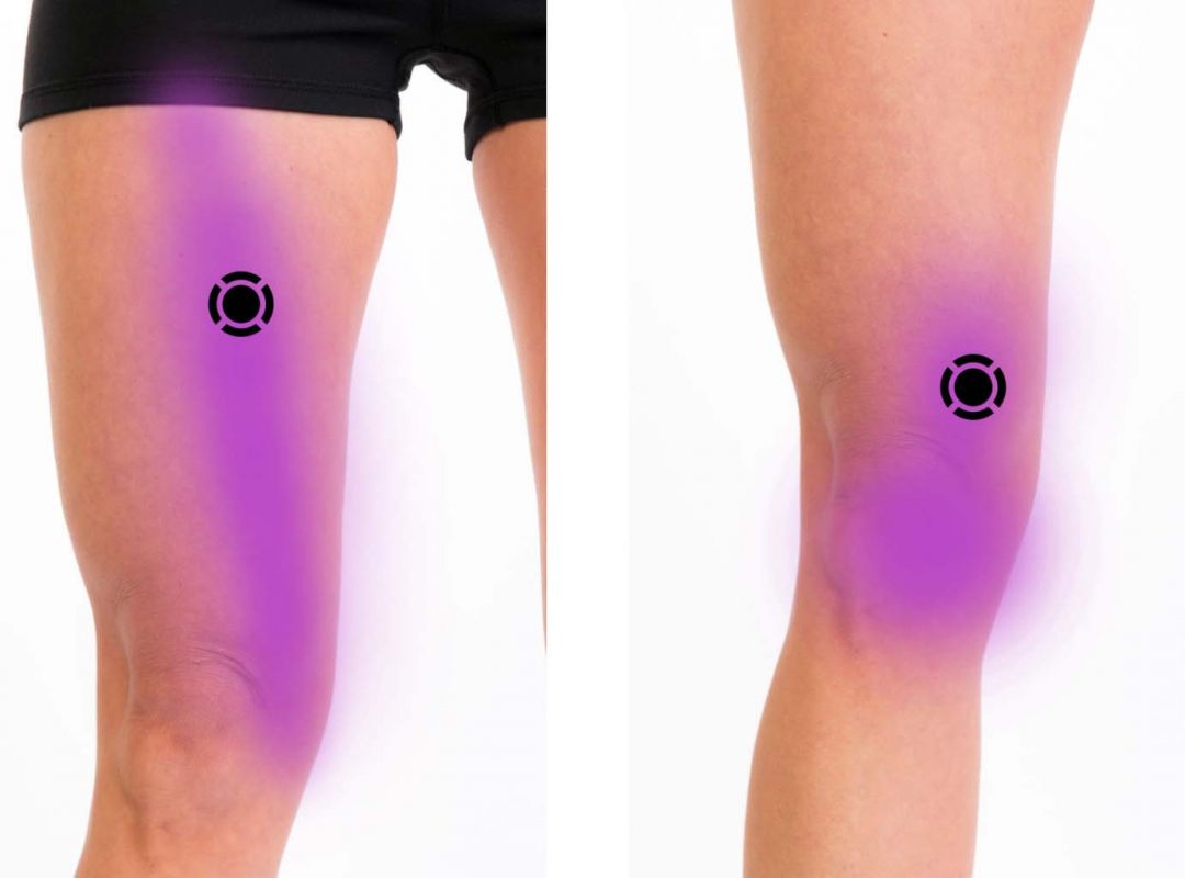 Anterior Thigh Pain – Komizo Diagnostics